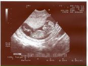 Фотография Лобова Вера